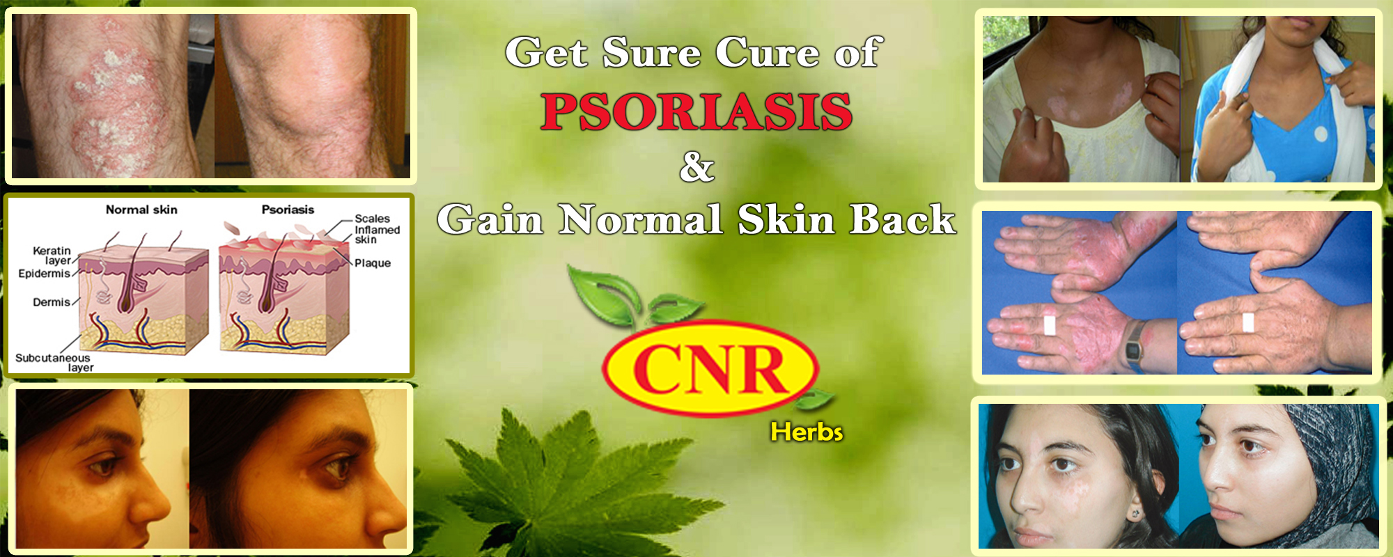 cnr banner2